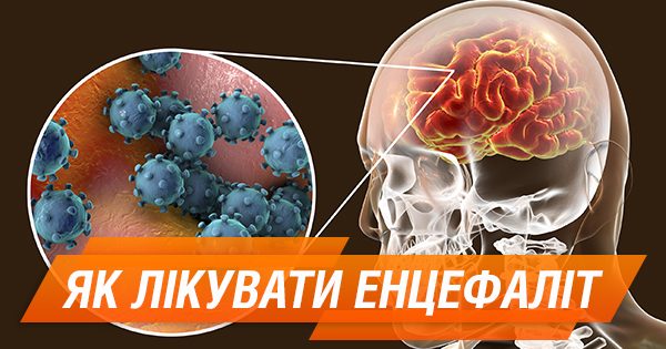 Что такое энцефалит и как его лечить