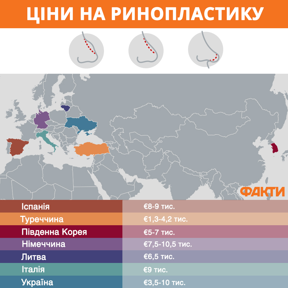 Ринопластика в Украине: цена и как найти хорошего врача Фото 4