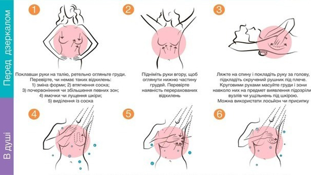 самообстеження молочних залоз
