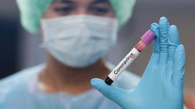 Статистика йде на спад: в Україні виявили 7 014 нових випадків Covid-19