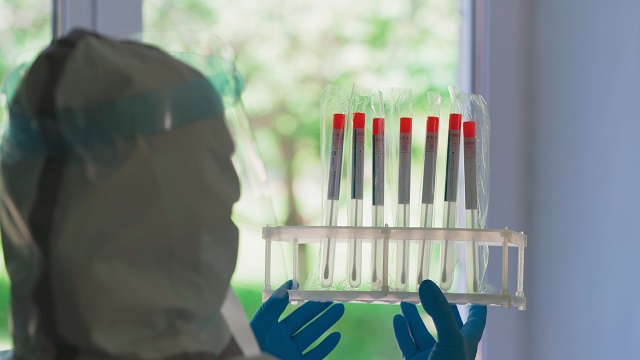 В Україні зафіксовано 12 585 нових випадків Covid-19, але одужань більше