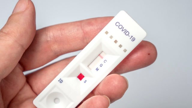 Близько 40% українців мають антитіла до Covid-19