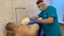Уламок відрізав руку, понівечив ногу: у Дніпрі врятували чоловіка після важкого поранення медики