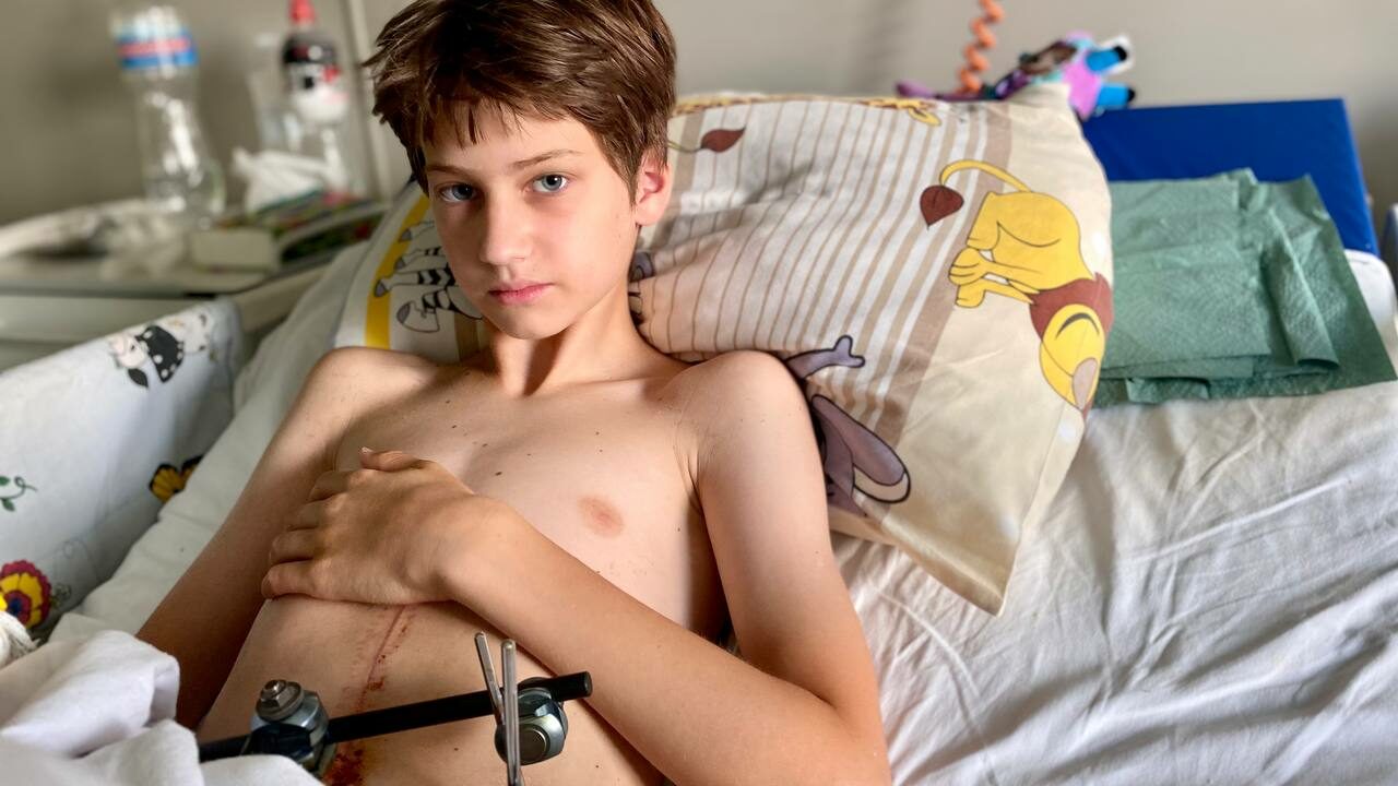 Оторвавшуюся почку пришлось удалить: в Охматдете спасли 13-летнего парня, которого сбила машина