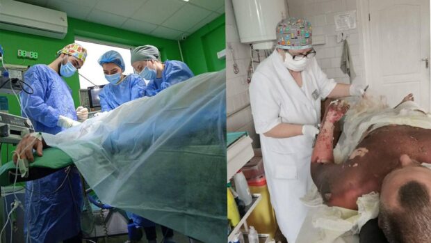 опікове відділення у Дніпрі
