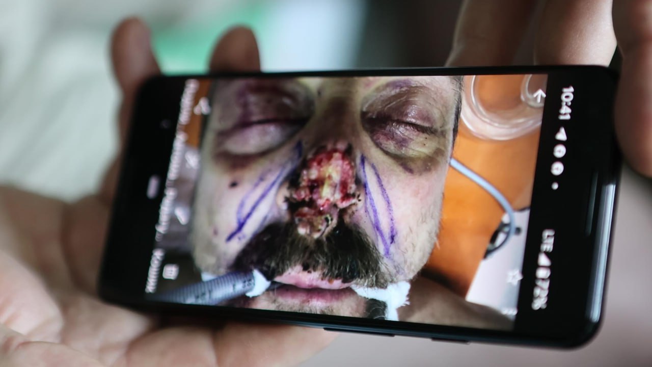 вигляд бійця після операції