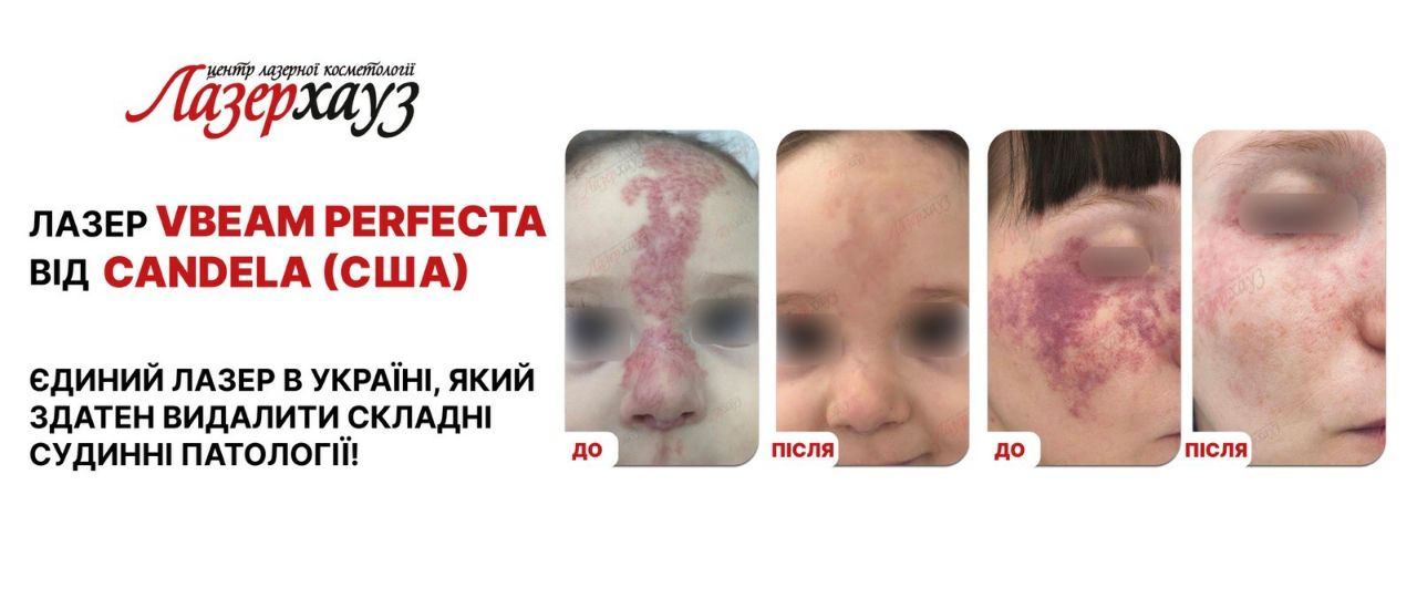 реклама