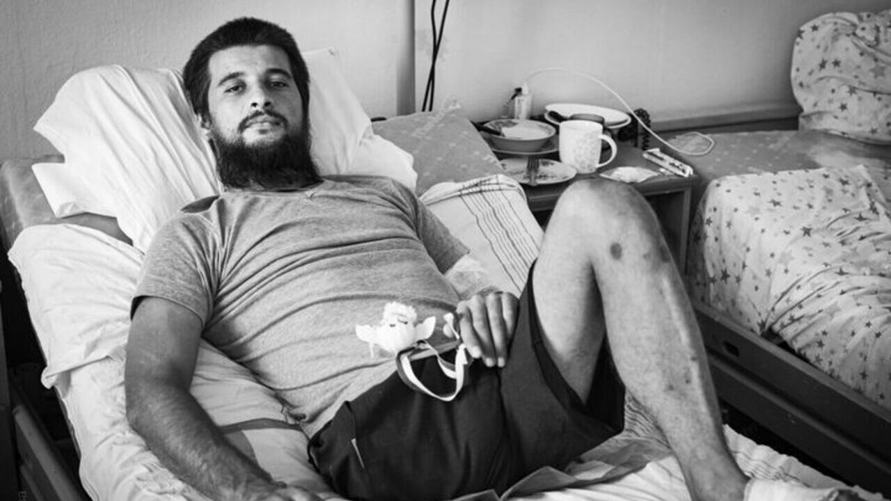 “Мені ще пощастило”. Наш боєць, що втратив ногу, розповів про поранення та реабілітацію