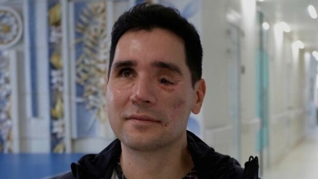 Летіло в нас все: наш воїн втратив зір після поранення і вчиться жити по-новому
