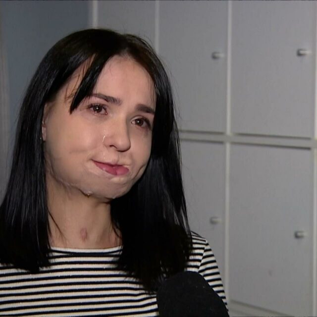 Хірурги з Польщі відновили обличчя 24-річної українки, яка дістала важке поранення Фото 1