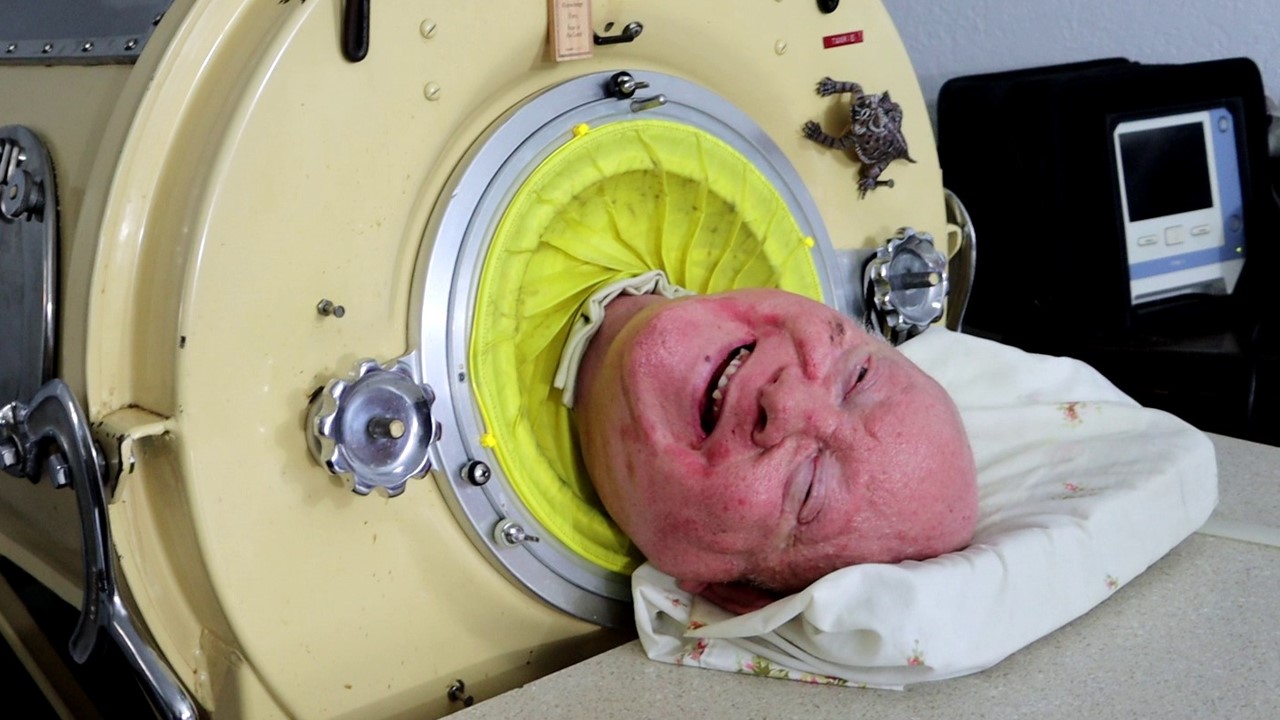 "людина в залізній легені