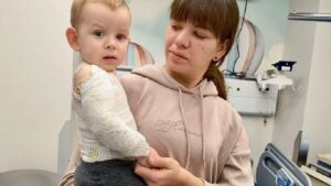опіки тіла у новий рік