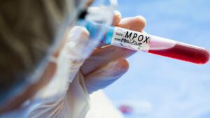 Mpox